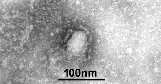 Corona, Virus, Erreger, Mikroskop, © IVDC / China CDC via GISAID / dpa