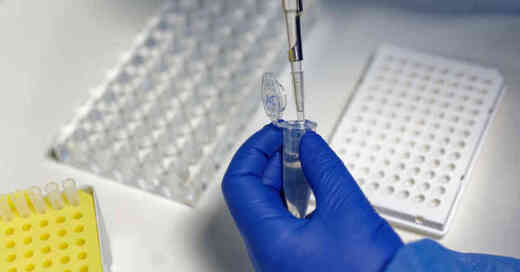 PCR-Test, Coronavirus, Labor, Auswertung, Corona, Covid-19, Kapazitäten, © Henning Kaiser - dpa (Archivbild)