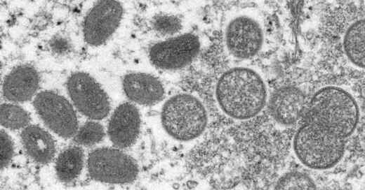 Affenpocken, Pocken, Erreger, Virus, Mikroskop, © Cynthia S. Goldsmith & Russell Regner - CDC / AP / dpa