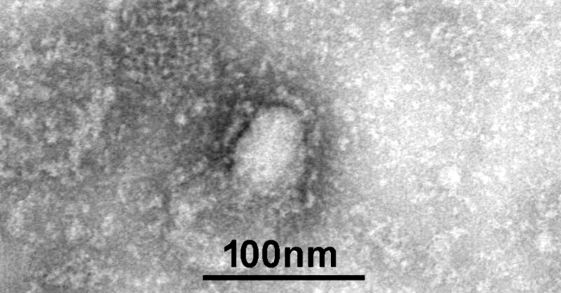 Corona, Virus, Erreger, Mikroskop, © IVDC / China CDC via GISAID / dpa